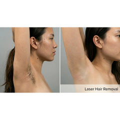 Kavvia DermaLux Diode Laser, a Lasers by Kavvia (OS) available at Dansons Medical