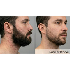 Kavvia DermaLux Diode Laser, a Lasers by Kavvia (OS) available at Dansons Medical