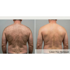 Kavvia DermaLux Diode Laser, a Lasers by Kavvia (OS) available at Dansons Medical